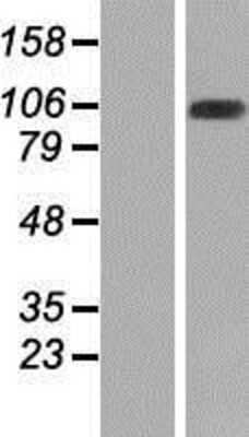 Western Blot: WDR67 Overexpression Lysate [NBP2-05482]