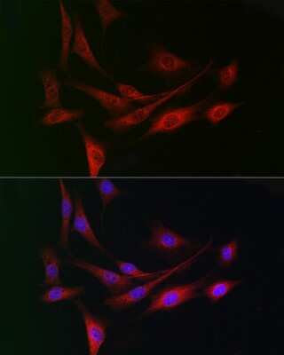Immunocytochemistry/ Immunofluorescence: WDR68 Antibody - Azide and BSA Free [NBP2-95210]