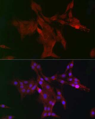 Immunocytochemistry/ Immunofluorescence: WDR68 Antibody - Azide and BSA Free [NBP2-95210]