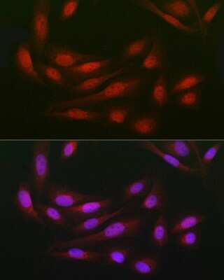 Immunocytochemistry/ Immunofluorescence: WDR68 Antibody - Azide and BSA Free [NBP2-95210]