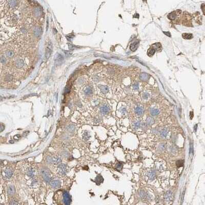 Immunohistochemistry-Paraffin: WDR68 Antibody [NBP1-92589]