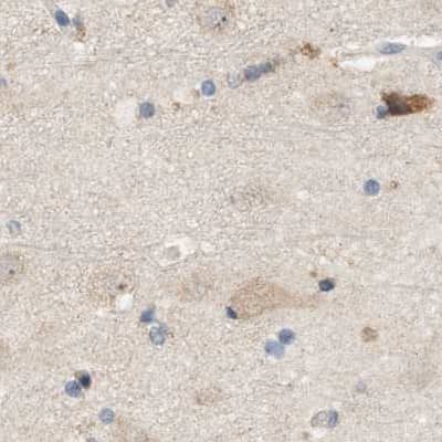 Immunohistochemistry-Paraffin: WDR68 Antibody [NBP1-92590]