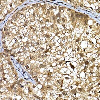 Immunohistochemistry-Paraffin: WDR68 Antibody - Azide and BSA Free [NBP2-95210]