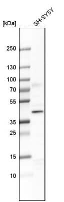 Western Blot: WDR68 Antibody [NBP1-92589]