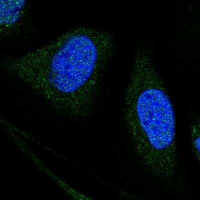 Immunocytochemistry/ Immunofluorescence: WDR7 Antibody [NBP2-14517]