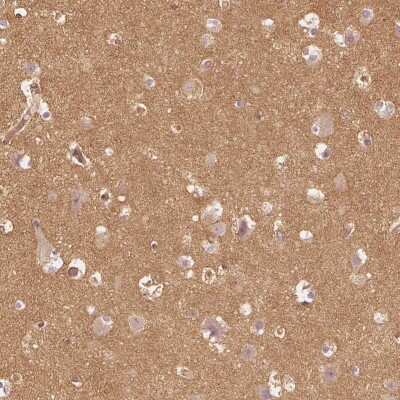 Immunohistochemistry: WDR7 Antibody [NBP2-68694]