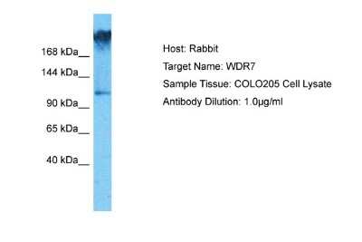 Western Blot: WDR7 Antibody [NBP2-86378]