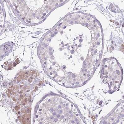 Immunohistochemistry: WDR70 Antibody [NBP2-48892]