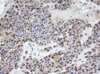 Immunohistochemistry: WDR74 Antibody (OTI4B2) [NBP2-45420]