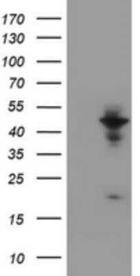 Western Blot: WDR74 Antibody (OTI4B2) [NBP2-45420]