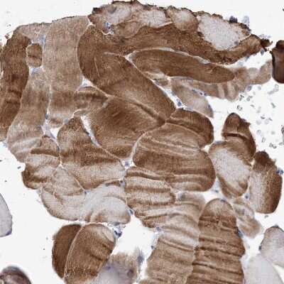 Immunohistochemistry: WDR74 Antibody [NBP2-38411]