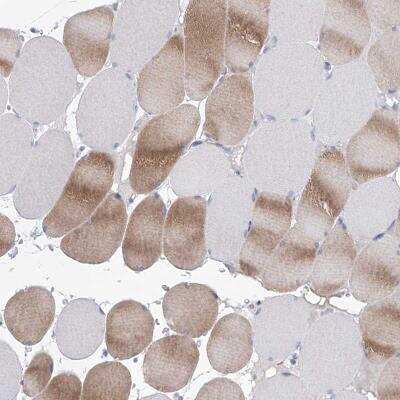 Immunohistochemistry-Paraffin: WDR74 Antibody [NBP1-84623]
