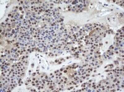 Immunohistochemistry: WDR74 Antibody (OTI4B2) - Azide and BSA Free [NBP2-74867]