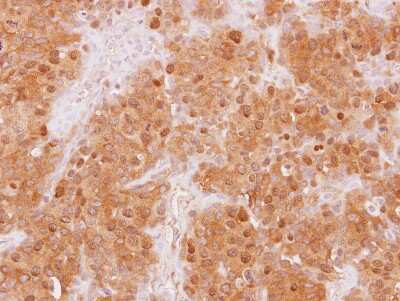 Immunohistochemistry-Paraffin: WDR77 Antibody [NBP2-20901]