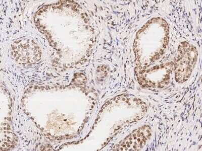 Immunohistochemistry-Paraffin: WDR77 Antibody [NBP2-98916]
