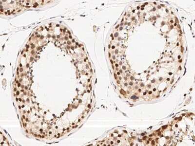 Immunohistochemistry-Paraffin: WDR77 Antibody [NBP2-98916]