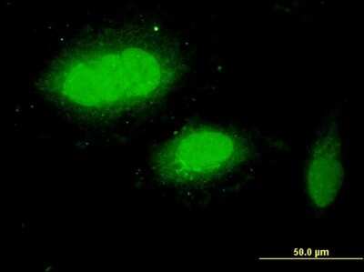 Immunocytochemistry/ Immunofluorescence: WDR79 Antibody (1F12) [H00055135-M04]