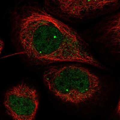 Immunocytochemistry/ Immunofluorescence: WDR79 Antibody [NBP1-92592]