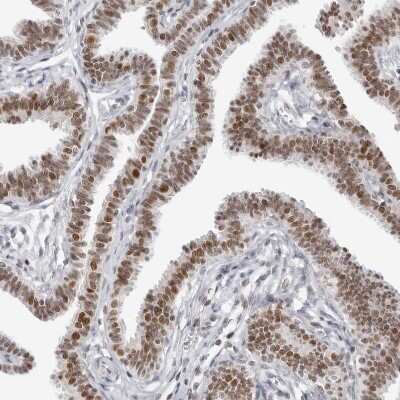 Immunohistochemistry-Paraffin: WDR79 Antibody [NBP1-92592]