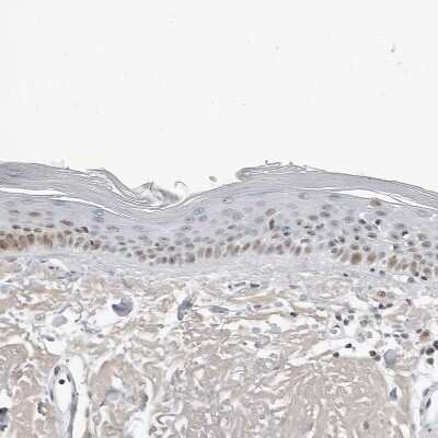 Immunohistochemistry-Paraffin: WDR79 Antibody [NBP1-92592]