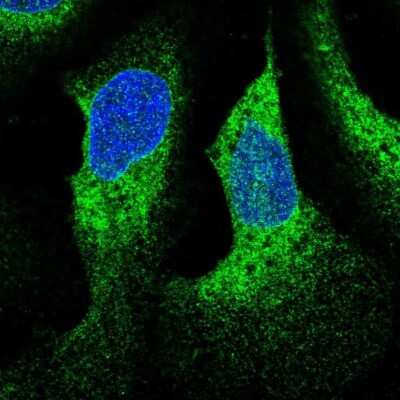 Immunocytochemistry/ Immunofluorescence: WDR83OS Antibody [NBP2-55905]
