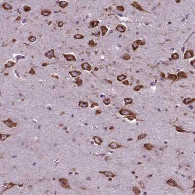 Immunohistochemistry-Paraffin: WDR83OS Antibody [NBP2-55905]