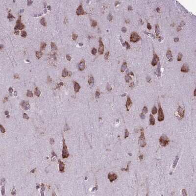 Immunohistochemistry-Paraffin: WDR83OS Antibody [NBP2-55905]
