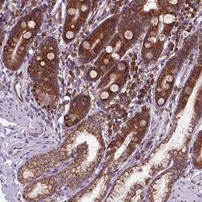 Immunohistochemistry-Paraffin: WDR83OS Antibody [NBP2-55905]