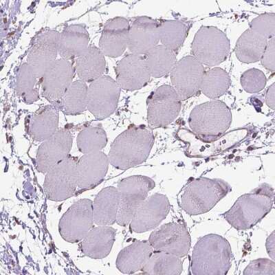 Immunohistochemistry-Paraffin: WDR83OS Antibody [NBP2-55905]