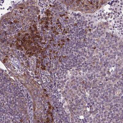 Immunohistochemistry-Paraffin: WDR83OS Antibody [NBP2-55905]
