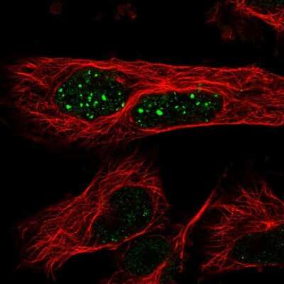 Immunocytochemistry/ Immunofluorescence: WDR85 Antibody [NBP1-86714]