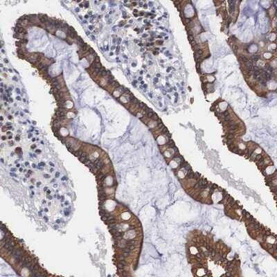 Immunohistochemistry-Paraffin: WDR89 Antibody [NBP1-88413]