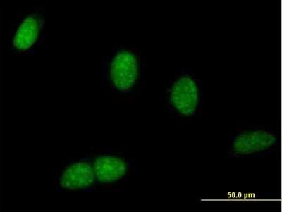 Immunocytochemistry/ Immunofluorescence: WDR9 Antibody [H00054014-B01P]