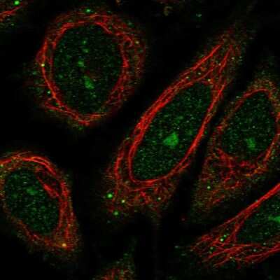 Immunocytochemistry/ Immunofluorescence: WDR9 Antibody [NBP2-38169]