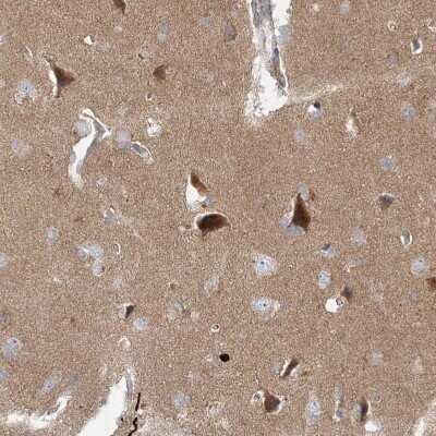 Immunohistochemistry-Paraffin: WDR9 Antibody [NBP1-89878]