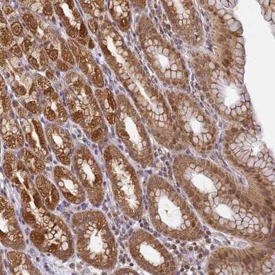 Immunohistochemistry-Paraffin: WDR92 Antibody [NBP1-92594]