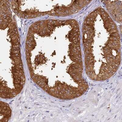Immunohistochemistry-Paraffin: WDR92 Antibody [NBP1-92595]