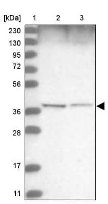 Western Blot: WDR92 Antibody [NBP1-92595]