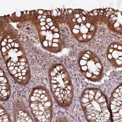 Immunohistochemistry-Paraffin: WDSOF1 Antibody [NBP2-47580]