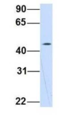 Western Blot: WDSOF1 Antibody [NBP1-70747]