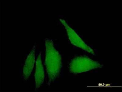 Immunocytochemistry/ Immunofluorescence: WDSUB1 Antibody [H00151525-B01P]
