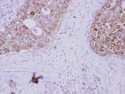 Immunohistochemistry-Paraffin: WDSUB1 Antibody [NBP2-20904]