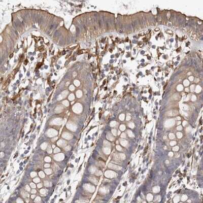 Immunohistochemistry-Paraffin: WDTC1 Antibody [NBP1-89233]