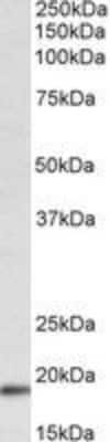 Western Blot: WFDC1 Antibody [NBP2-27546]