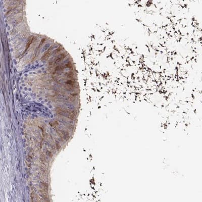 Immunohistochemistry-Paraffin: WFDC8 Antibody [NBP2-62608]