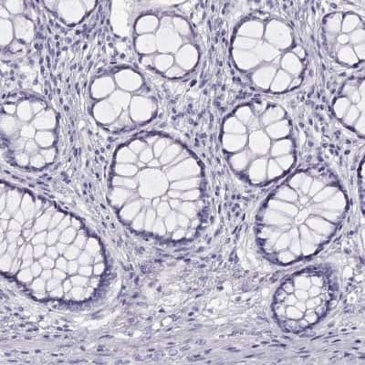 Immunohistochemistry-Paraffin: WFDC8 Antibody [NBP2-62608]