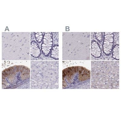 Immunohistochemistry-Paraffin: WFDC8 Antibody [NBP2-62608]
