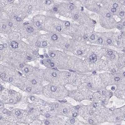 Immunohistochemistry-Paraffin: WFDC8 Antibody [NBP2-62608]