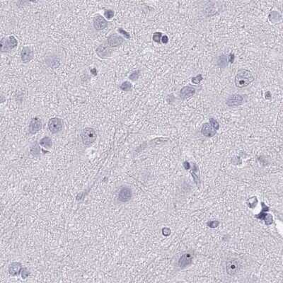 Immunohistochemistry-Paraffin: WFDC8 Antibody [NBP2-62608]