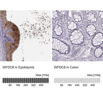 Immunohistochemistry-Paraffin: WFDC8 Antibody [NBP2-62671]